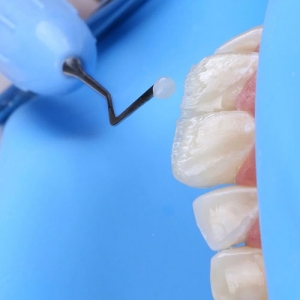 لمینت کامپوزیتی