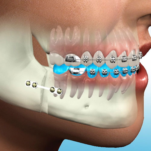 جراحی فک و صورت در کرج