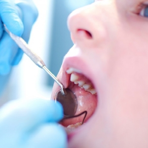 نحوه تشخیص پوسیدگی دندان