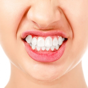 براکسیسم (دندان قروچه) چیست؟
