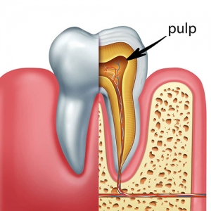 پالپ دندان چیست؟